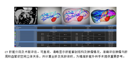 3D可視化技術(shù) 外科手術(shù)的“GPS”